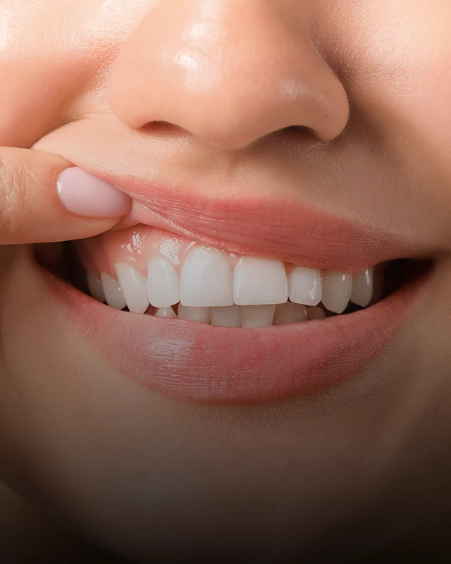 A patient pulling back their top lip to show healthy gums